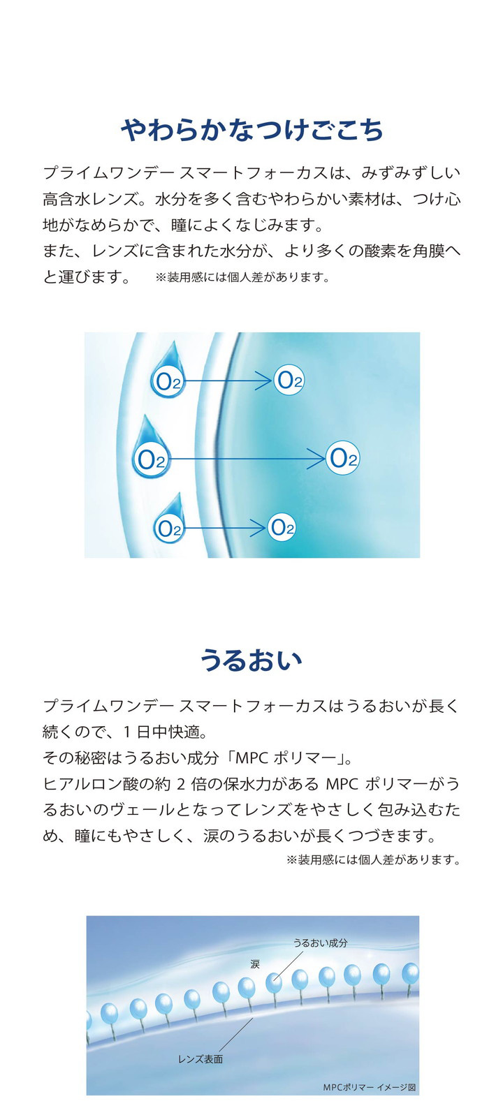 スマートフォーカスと近視用レンズの違い